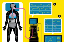 机器学习+ICU：为重症患者提供实时护理