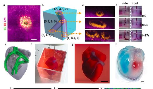 世界上首颗3D打印心脏问世！有血有肉会跳动